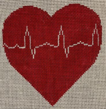 Heart - Cardiac Rhythm